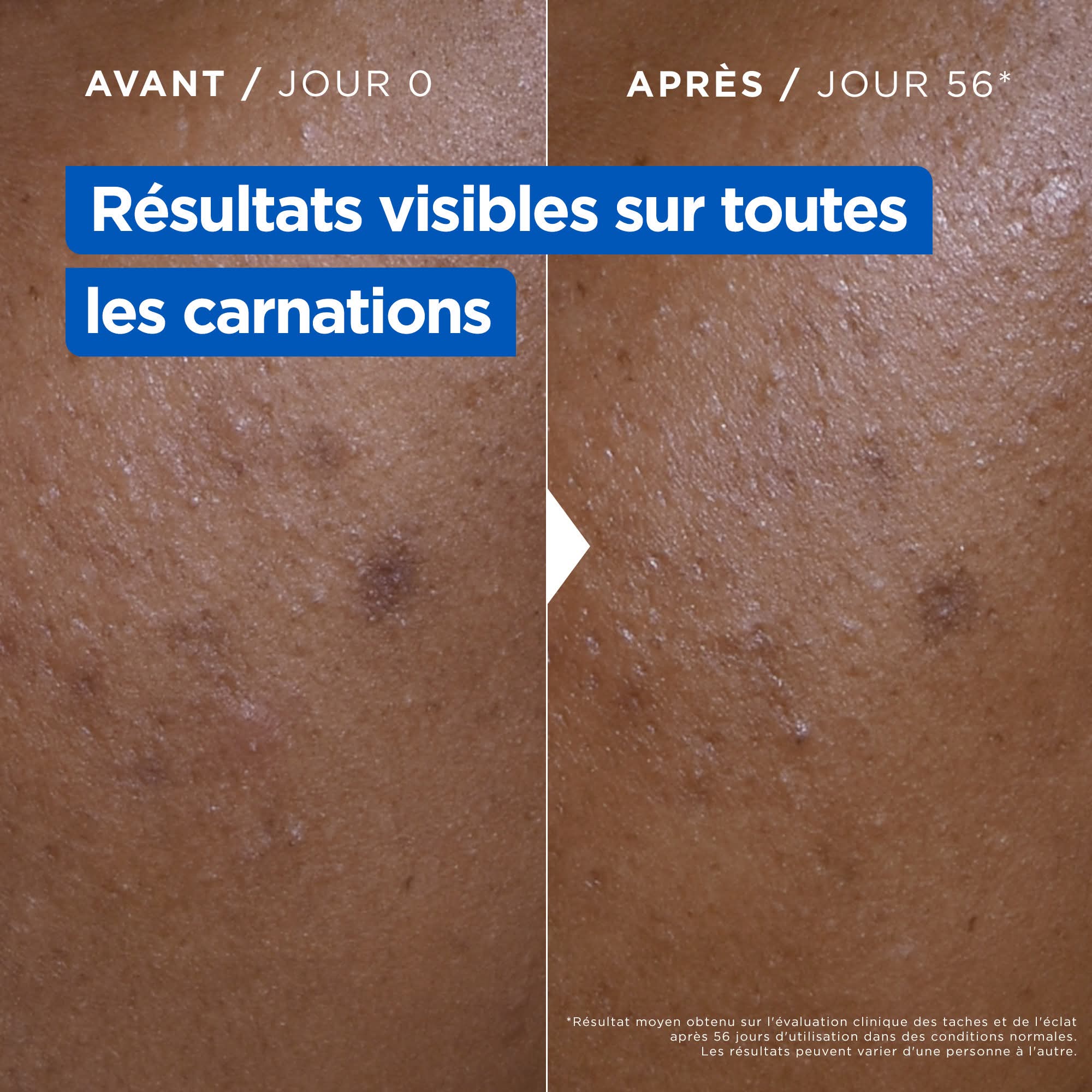 MIXA Niacinamide